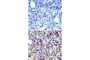 Immunohistochemical analysis of Cd207 in paraffin-embedded formalin-fixed mouse breast tissue using an isotype control (top) and Cd207 polyclonal antibody  (bottom) at 5 ug/mL . (CD207 抗体  (AA 36-44))