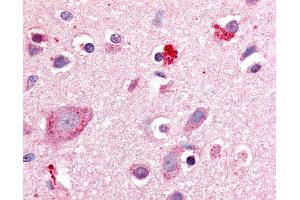Anti-ROR Beta antibody IHC of human brain, cortex. (RORB 抗体  (Hinge Region))