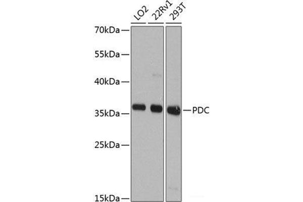 Phosducin 抗体