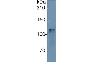 Western Blot; Sample: Mouse Heart lysate; Primary Ab: 1µg/ml Rabbit Anti-Mouse HK1 Antibody Second Ab: 0. (Hexokinase 1 抗体  (AA 137-270))