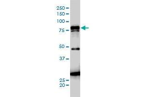 JUP monoclonal antibody (M01), clone 2G9 Western Blot analysis of JUP expression in A-431 .