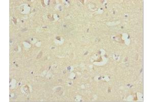 Immunohistochemistry of paraffin-embedded human brain tissue using ABIN7167729 at dilution of 1:100 (RFPL2 抗体  (AA 99-378))