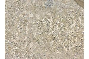 ABIN6257727 and ABIN6274542 at 1/100 staining human normal liver tissue by IHC-P. (SHPK 抗体  (N-Term))