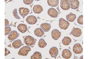 IHC analysis of DAZAP1 using anti-DAZAP1 antibody (ABIN6719309).