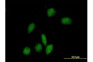 Immunofluorescence of purified MaxPab antibody to ARHGAP9 on HeLa cell. (ARHGAP9 抗体  (AA 1-750))