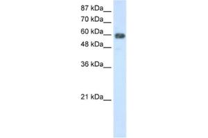Western Blotting (WB) image for anti-TROVE Domain Family, Member 2 (TROVE2) antibody (ABIN2462169) (TROVE2 抗体)