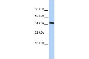 WB Suggested Anti-DYSFIP1 Antibody Titration: 0. (PPP1R27 抗体  (Middle Region))