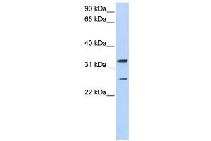 WB Suggested Anti-KCNIP2  Antibody Titration: 0. (KCNIP2 抗体  (N-Term))