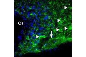 Expression of P2X1 Receptor in rat hypothalamus - Immunohistochemical staining of rat supra-optic nucleus using Anti-P2X1 Receptor Antibody (ABIN7043570, ABIN7045074 and ABIN7045075). (P2RX1 抗体  (Intracellular))