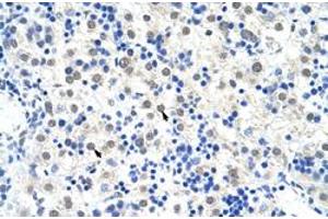 Immunohistochemical staining (Formalin-fixed paraffin-embedded sections) of human liver with DDX47 polyclonal antibody  at 4-8 ug/mL working concentration.