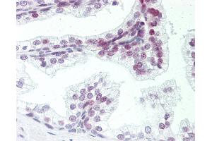 Immunohistochemistry (IHC) image for anti-Zinc Finger, MYM-Type 6 (ZMYM6) (AA 17-66) antibody (ABIN6755297)