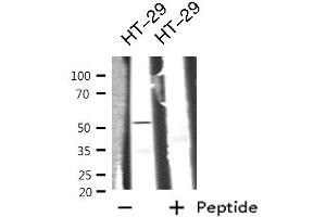 Western blot analysis GIPR  using HT-29 whole cell lysates (GIPR 抗体  (Internal Region))