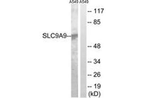 Western Blotting (WB) image for anti-Solute Carrier Family 9, Subfamily A (NHE9, Cation Proton Antiporter 9), Member 9 (SLC9A9) (AA 171-220) antibody (ABIN2890645) (SLC9A9 抗体  (AA 171-220))
