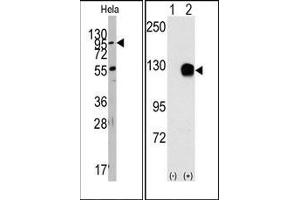 Image no. 1 for anti-TYRO3 Protein Tyrosine Kinase (TYRO3) antibody (ABIN359941) (TYRO3 抗体)