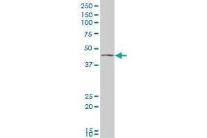 VAT1 polyclonal antibody (A01), Lot # 060608JCS1 Western Blot analysis of VAT1 expression in Jurkat . (VAT1 抗体  (AA 294-392))