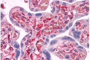 Human Placenta: Formalin-Fixed, Paraffin-Embedded (FFPE) (SHMT1 抗体  (AA 374-483))