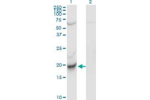 Western Blot analysis of CENPM expression in transfected 293T cell line by C22orf18 monoclonal antibody (M01), clone 4C12-2C8. (CENPM 抗体  (AA 1-180))
