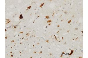 Immunoperoxidase of monoclonal antibody to PTN on formalin-fixed paraffin-embedded human cerebral cortex. (Pleiotrophin 抗体  (AA 45-154))