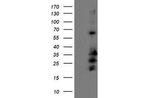 Western Blotting (WB) image for anti-Receptor Accessory Protein 2 (REEP2) antibody (ABIN1500658) (REEP2 抗体)
