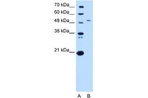 WB Suggested Anti-SPTLC1 Antibody Titration:  0. (SPTLC1 抗体  (Middle Region))