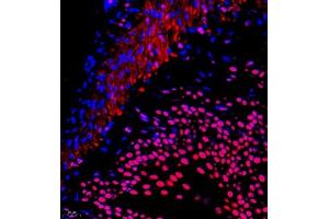 Immunofluorescence (Paraffin-embedded Sections) (IF (p)) image for anti-Prothymosin, alpha (PTMA) antibody (ABIN7075306)