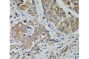 Immunohistochemistry (Paraffin-embedded Sections) (IHC (p)) image for anti-Transient Receptor Potential Cation Channel, Subfamily A, Member 1 (TRPA1) antibody (ABIN7264621)