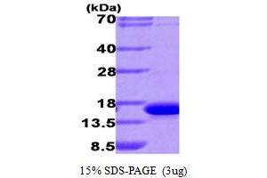 Lectin, Galactoside-Binding, Soluble, 9 (LGALS9) (AA 1-148) (Active) protein (His tag)