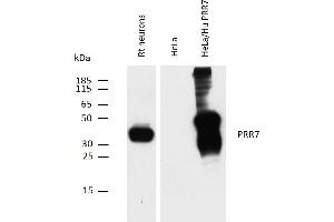 Western blotting analysis of PRR7 using mouse monoclonal antibody TRAP3/10 on rat neuron lysate, and on HeLa transfectants overexpressing human PRR7, compared with non-transfected HeLa cells (negative control). (PRR7 抗体  (C-Term, Intracellular))