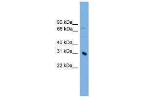 PRSS8 antibody used at 1 ug/ml to detect target protein. (PRSS8 抗体  (Middle Region))
