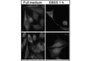 Immunofluorescence staining of Autophagy GABARAP Antibody (N-term) Cat. (GABARAP 抗体  (N-Term))
