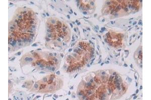 Immunohistochemistry (IHC) image for anti-Transferrin Receptor 2 (TFR2) (AA 4-87) antibody (ABIN7431464)