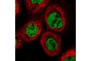 Immunofluorescent staining of human cell line A-431 with PRCC polyclonal antibody  at 1-4 ug/mL dilution shows positivity in nucleus but not nucleoli. (PRCC 抗体)