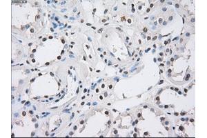 Immunohistochemical staining of paraffin-embedded Kidney tissue using anti-FCGR2A mouse monoclonal antibody. (FCGR2A 抗体)