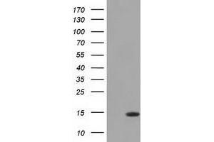 Western Blot analysis of HEK293T cell lysates (5 ug) transfected with either recombinant CISD1 protein (Right) or empty vector (Left) detected with CISD1 antibody (CISD1 抗体)