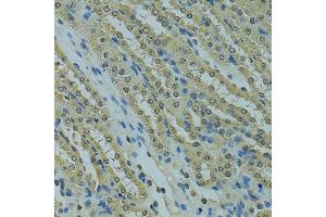Immunohistochemistry of paraffin-embedded mouse kidney using UBE2I antibody. (UBE2I 抗体  (AA 1-158))