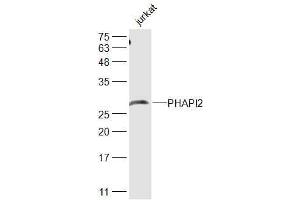 Image no. 1 for anti-Acidic (Leucine-Rich) Nuclear phosphoprotein 32 Family, Member B (ANP32B) (AA 51-150) antibody (ABIN872630)