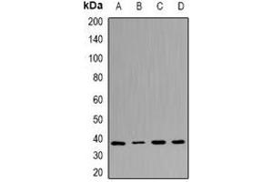 Western blot analysis of UFD1L expression in Jurkat (A), A431 (B), mouse heart (C), rat brain (D) whole cell lysates. (UFD1L 抗体)