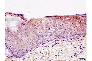 Formalin-fixed and paraffin embedded rat skin tissue labeled with Anti-Integrin beta 1/CD29 Polyclonal Antibody (ABIN669216), Unconjugated at 1:200, followed by conjugation to the secondary antibody and DAB staining (ITGB1 抗体  (AA 25-100))
