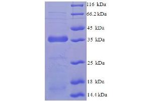SDS-PAGE (SDS) image for Protein Tyrosine Phosphatase, Mitochondrial 1 (PTPMT1) (AA 28-201) protein (His-SUMO Tag) (ABIN5711527)