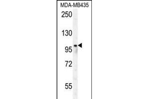 RP8 Antibody (Center) (ABIN650978 and ABIN2840019) western blot analysis in MDA-M cell line lysates (35 μg/lane). (PARP8 抗体  (AA 632-660))