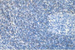 anti-B-Cell CLL/lymphoma 2 (BCL2) antibody