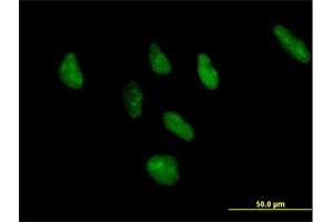 Immunofluorescence of purified MaxPab antibody to ZNF346 on HeLa cell. (ZNF346 抗体  (AA 1-294))
