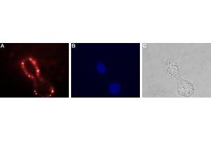 Immunocytochemistry (ICC) image for anti-Vasoactive Intestinal Peptide Receptor 1 (VIPR1) (AA 52-65), (Extracellular) antibody (ABIN7043875)