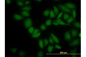Immunofluorescence of monoclonal antibody to SGK2 on HeLa cell. (SGK2 抗体  (AA 293-367))