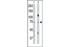 Western Blotting (WB) image for anti-Bone Morphogenetic Protein Receptor 1A (BMPR1A) (AA 1-30), (N-Term) antibody (ABIN388736)
