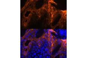 Immunofluorescence (IF) image for anti-Small Proline Rich Protein 1A (SPRR1A) antibody (ABIN7270369)