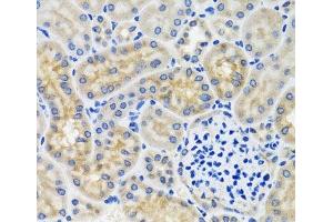 Immunohistochemistry of paraffin-embedded Mouse kidney using ANTXR2 Polyclonal Antibody at dilution of 1:100 (40x lens). (ANTXR2 抗体)