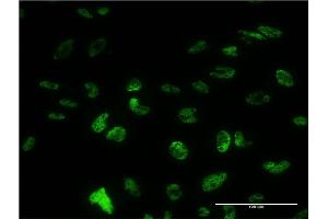 Immunofluorescence of monoclonal antibody to PUF60 on HeLa cell. (PUF60 抗体  (AA 1-516))