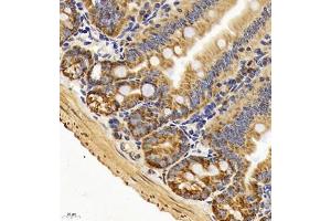Immunohistochemistry of paraffin embedded mouse duodenum using TAF4 (ABIN7075827) at dilution of 1:450 (400x lens) (TAF4 抗体)