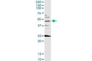 FOXF2 monoclonal antibody (M08), clone 3D11. (FOXF2 抗体  (AA 346-443))